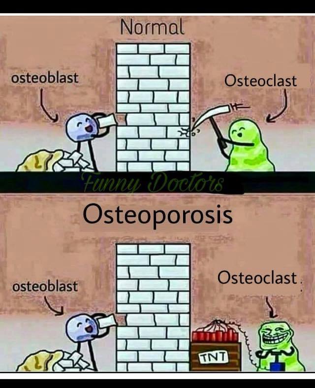Osteoporoza